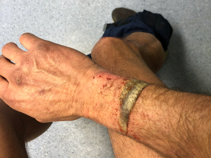 Η Αλήθεια για την Επιχείρηση των Πυροσβεστών στα Τέμπη σύμφωνα με μαρτυρίες και καταθέσεις