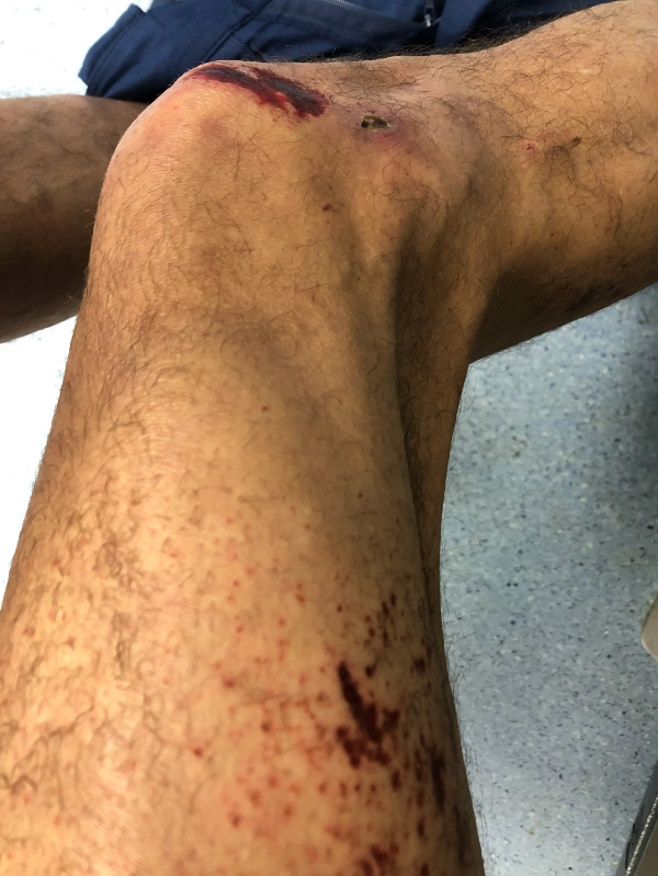 Η Αλήθεια για την Επιχείρηση των Πυροσβεστών στα Τέμπη σύμφωνα με μαρτυρίες και καταθέσεις