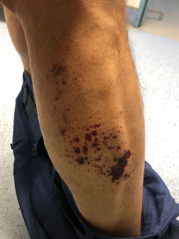 Η Αλήθεια για την Επιχείρηση των Πυροσβεστών στα Τέμπη σύμφωνα με μαρτυρίες και καταθέσεις